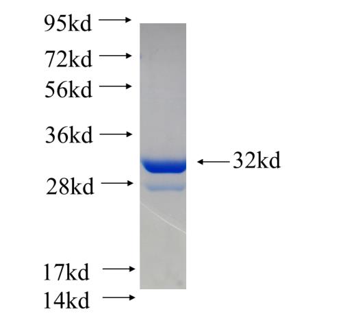 Recombinant human RGS4 SDS-PAGE