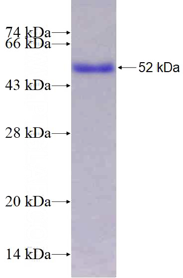 Recombinant Human SMAD7 SDS-PAGE