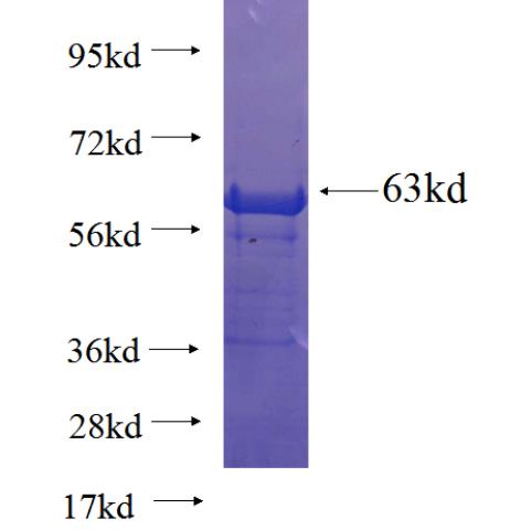 Recombinant human PCDHB15 SDS-PAGE