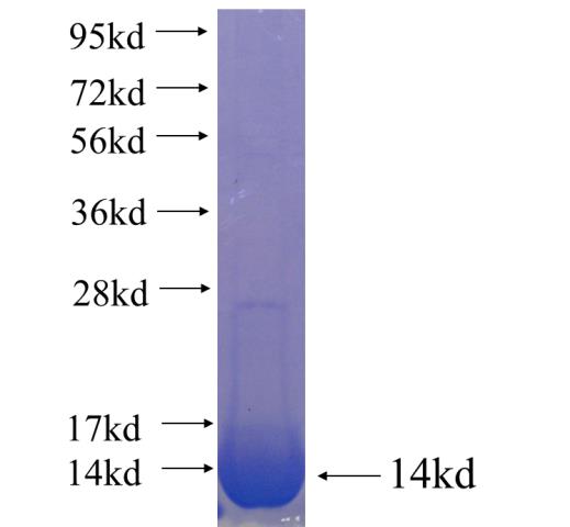 Recombinant human SLC2A9 SDS-PAGE