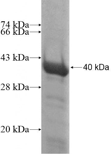 Recombinant Human HADH SDS-PAGE