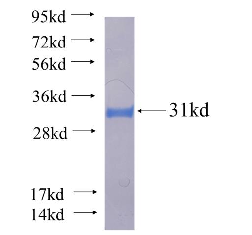 Recombinant human CSNK2B SDS-PAGE