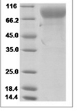 Human MCSF Receptor/CSF1R/CD115 Protein 15087