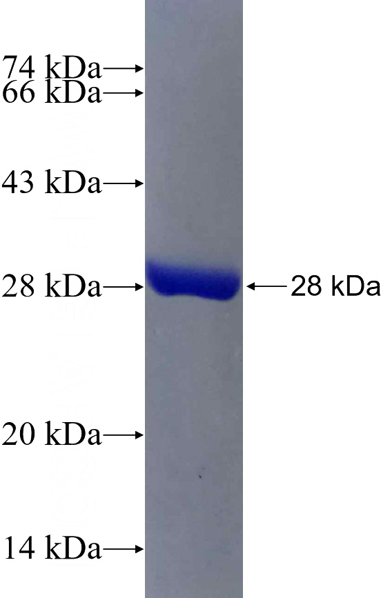 Recombinant Human SARM1 SDS-PAGE