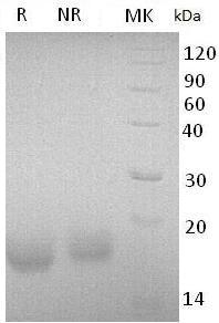 Human ACVR1/ACVRLK2 (His tag) recombinant protein