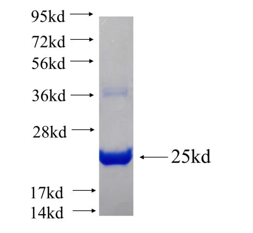Recombinant human RTKN2 SDS-PAGE
