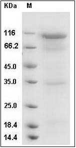 Human DPP4 / DPPIV / CD26 Protein SDS-PAGE