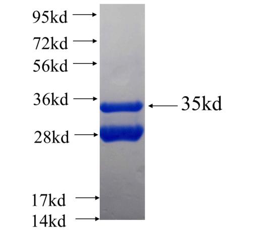 Recombinant human ANKRD13D SDS-PAGE