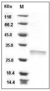 Human RPE / RPE2-1 Protein (His Tag) SDS-PAGE