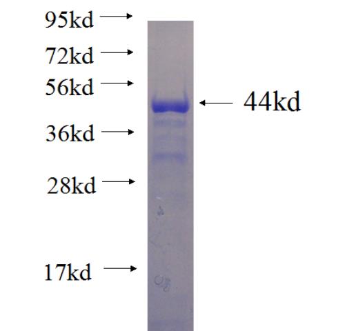 Recombinant human KLF5 SDS-PAGE