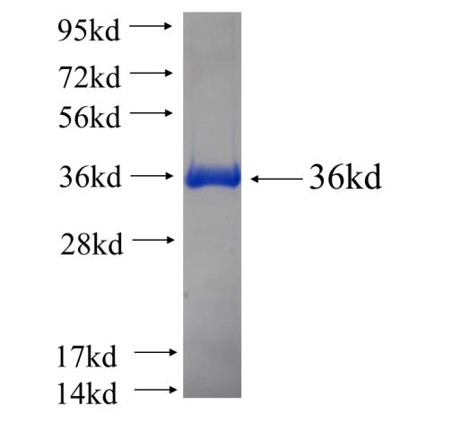 Recombinant human HMG20B SDS-PAGE