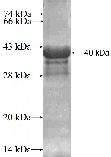 Recombinant Human RABIF SDS-PAGE