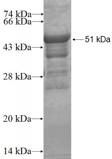 Recombinant Human NET1 SDS-PAGE