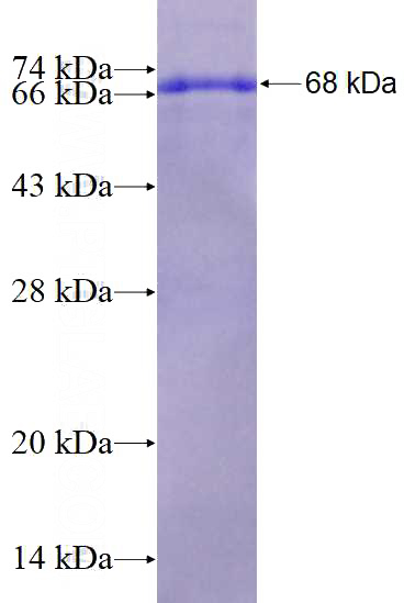 Recombinant Human ACTA1 SDS-PAGE