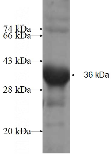 Recombinant Human MTMR8 SDS-PAGE