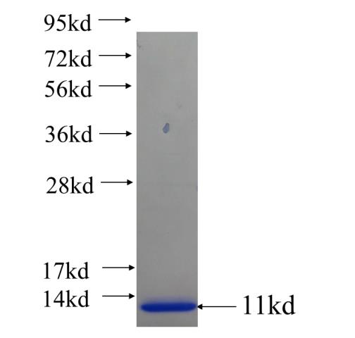 Recombinant human ZNF320 SDS-PAGE