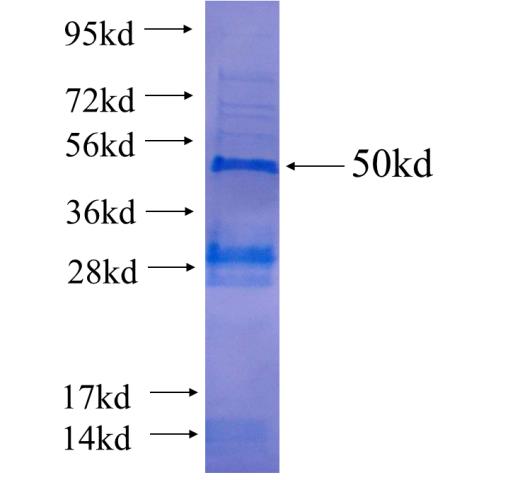Recombinant human DUSP11 SDS-PAGE