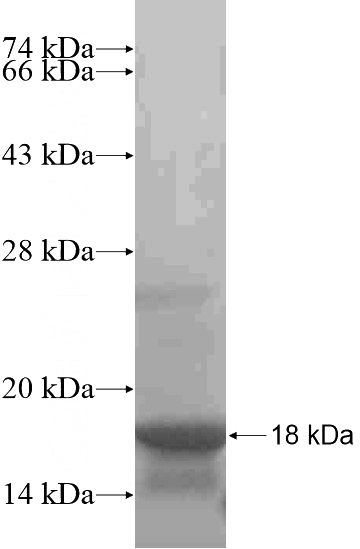 Recombinant Human MICAL3 SDS-PAGE