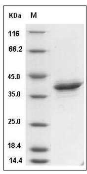 Rat NAP-2 / PPBP / CXCL7 Protein (Fc Tag) SDS-PAGE