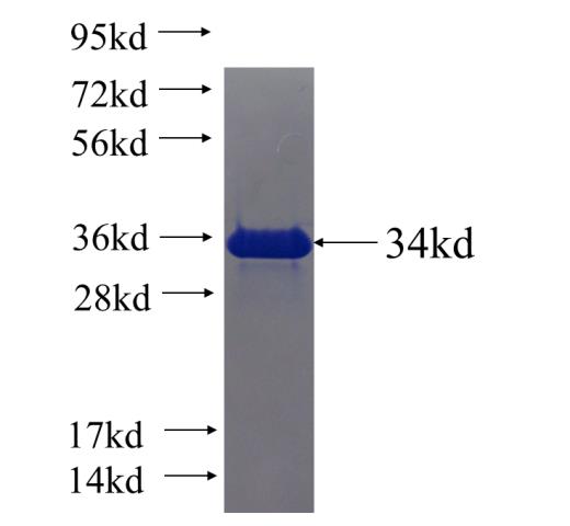 Recombinant human ATXN3L SDS-PAGE