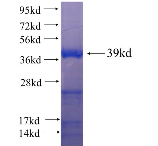 Recombinant human LIMK2 SDS-PAGE
