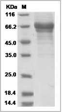 Human VTN / Vitronectin Protein (His Tag) SDS-PAGE