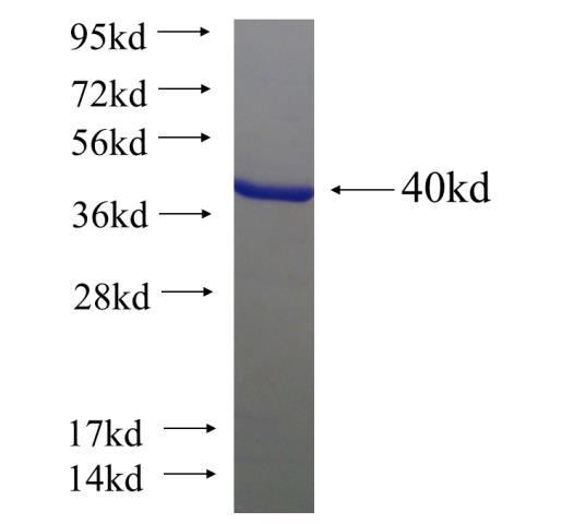 Recombinant human CORO1C SDS-PAGE