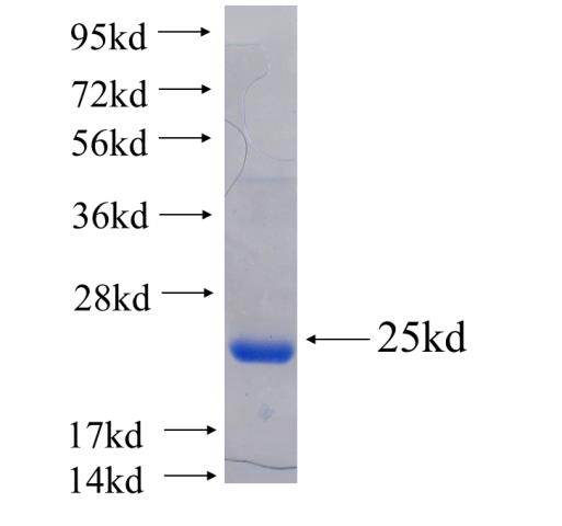 Recombinant human MYL2 SDS-PAGE