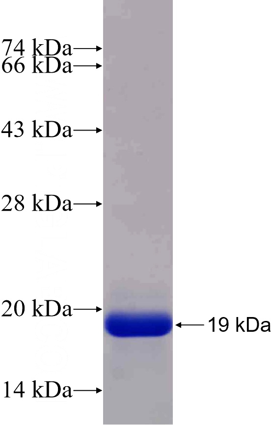 Recombinant Human MYL9 SDS-PAGE