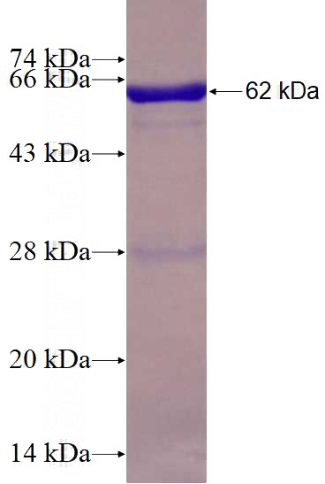 Recombinant Human EIF2S1 SDS-PAGE