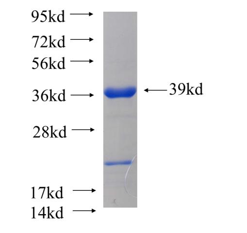 Recombinant human NHLRC1 SDS-PAGE