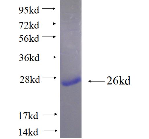 Recombinant human NDUFAF4 SDS-PAGE