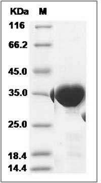 Human GPD1 / Glycerolphosphate Dehydrogenase 1 Protein (His Tag) SDS-PAGE