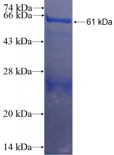 Recombinant Human C4BPA SDS-PAGE