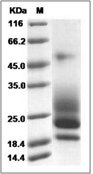 Cynomolgus CD83 Protein (His Tag) SDS-PAGE