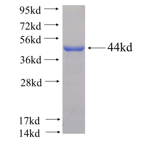 Recombinant human MTMR12 SDS-PAGE