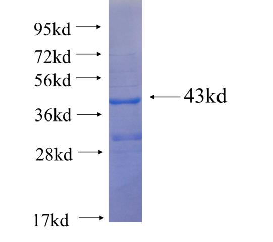 Recombinant human OTOP1 SDS-PAGE