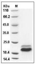 Human TRAIL R2 / CD262 / TNFRSF10B Protein (His Tag) SDS-PAGE
