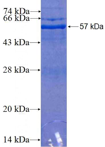 Recombinant Human COPS6 SDS-PAGE