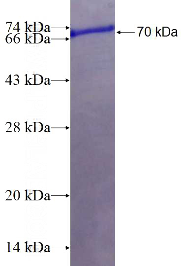 Recombinant Human NFKBIB SDS-PAGE