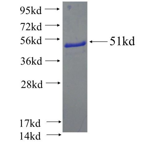 Recombinant human UBTD2 SDS-PAGE