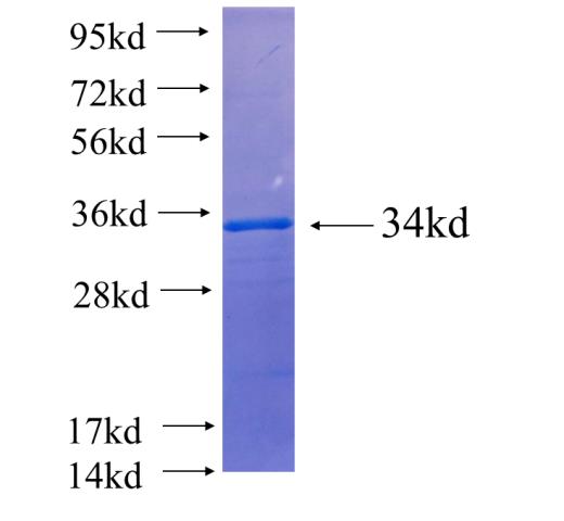 Recombinant human SLC2A3 SDS-PAGE