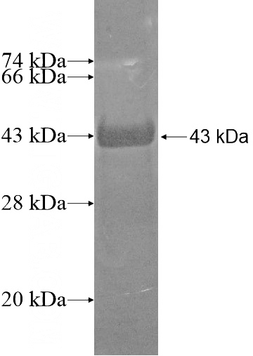 Recombinant Human STARD13 SDS-PAGE