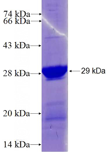 Recombinant Human APOB SDS-PAGE