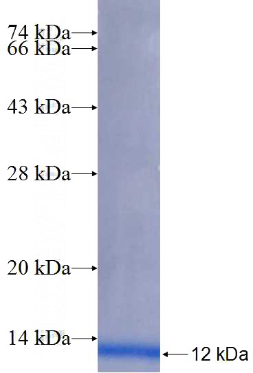 Human EFNA1 Recombinant protein (6*His tag)