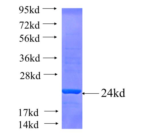 Recombinant human EGLN1 SDS-PAGE