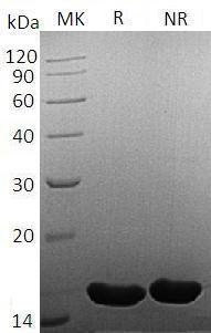 Human FGF4/HST/HSTF1/KS3 recombinant protein