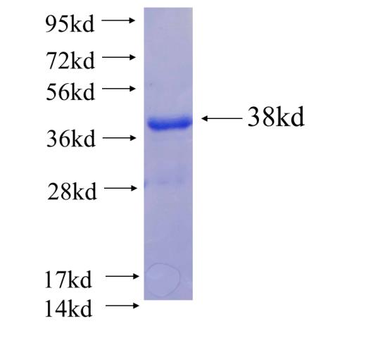 Recombinant human ZBTB48 SDS-PAGE