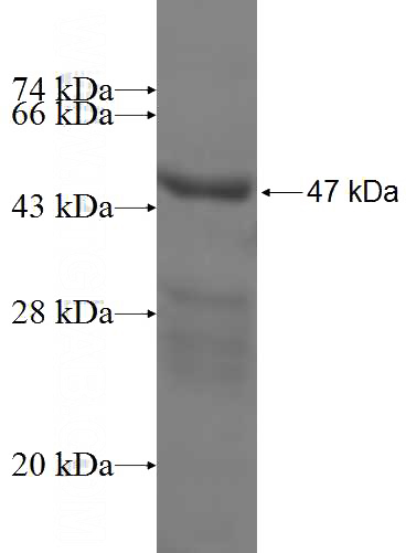 Recombinant Human MRPL11 SDS-PAGE