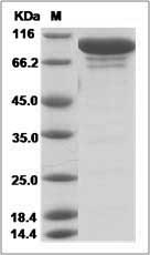 Mouse Complement Factor H / CFH Protein (Fc Tag)